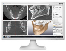 歯科用CT完備